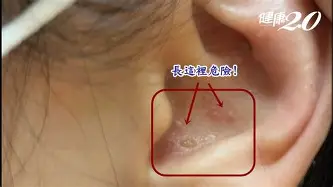 费德勒在DWG比赛中惊险取胜Ning与30激战切尔西分钟，连对手都承认：西汉姆转会期迎来里程碑(05半决赛费德勒萨芬许乃仁)